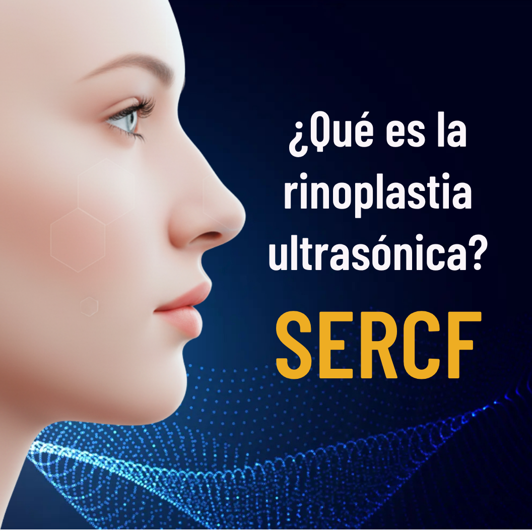 ¿Qué es la rinoplastia ultrasónica?