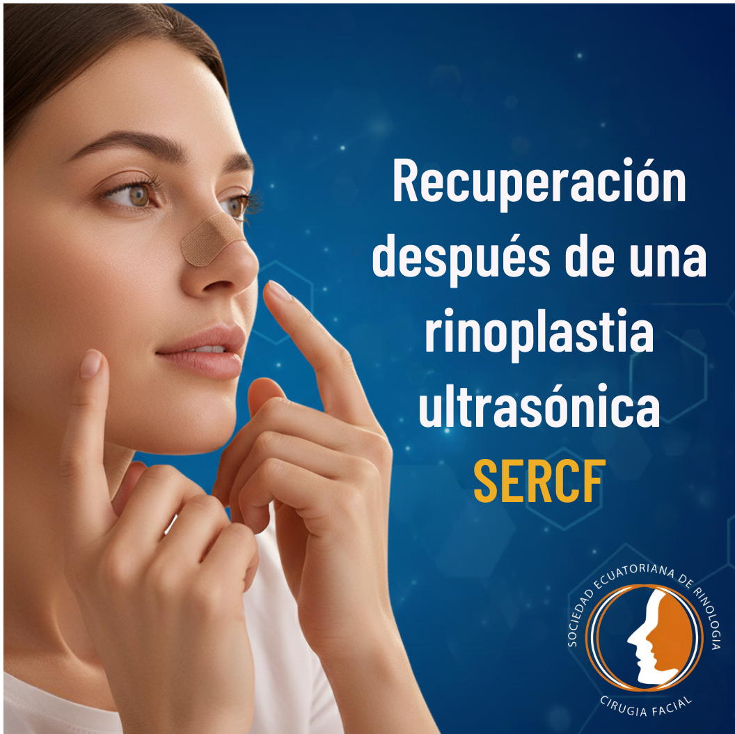 Recuperación después de una rinoplastia ultrasónica