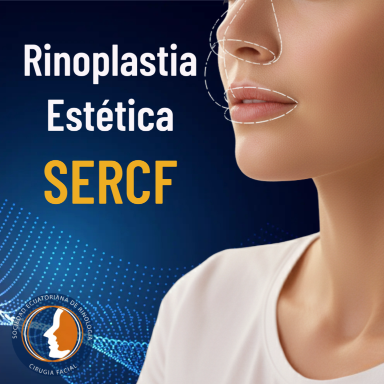 Rinoplastia estética