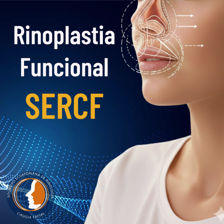Rinoplastia funcional