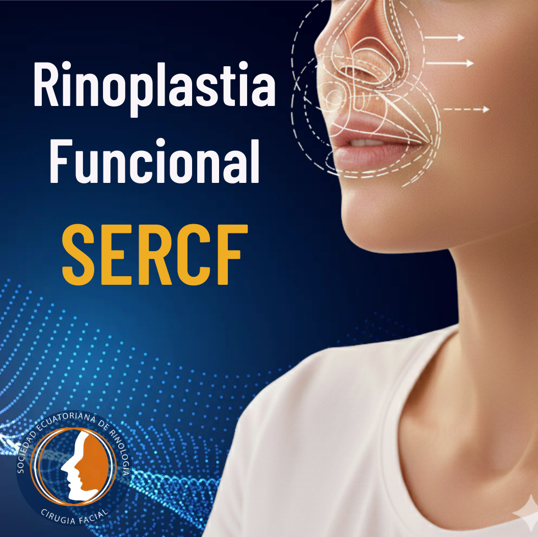Rinoplastia funcional