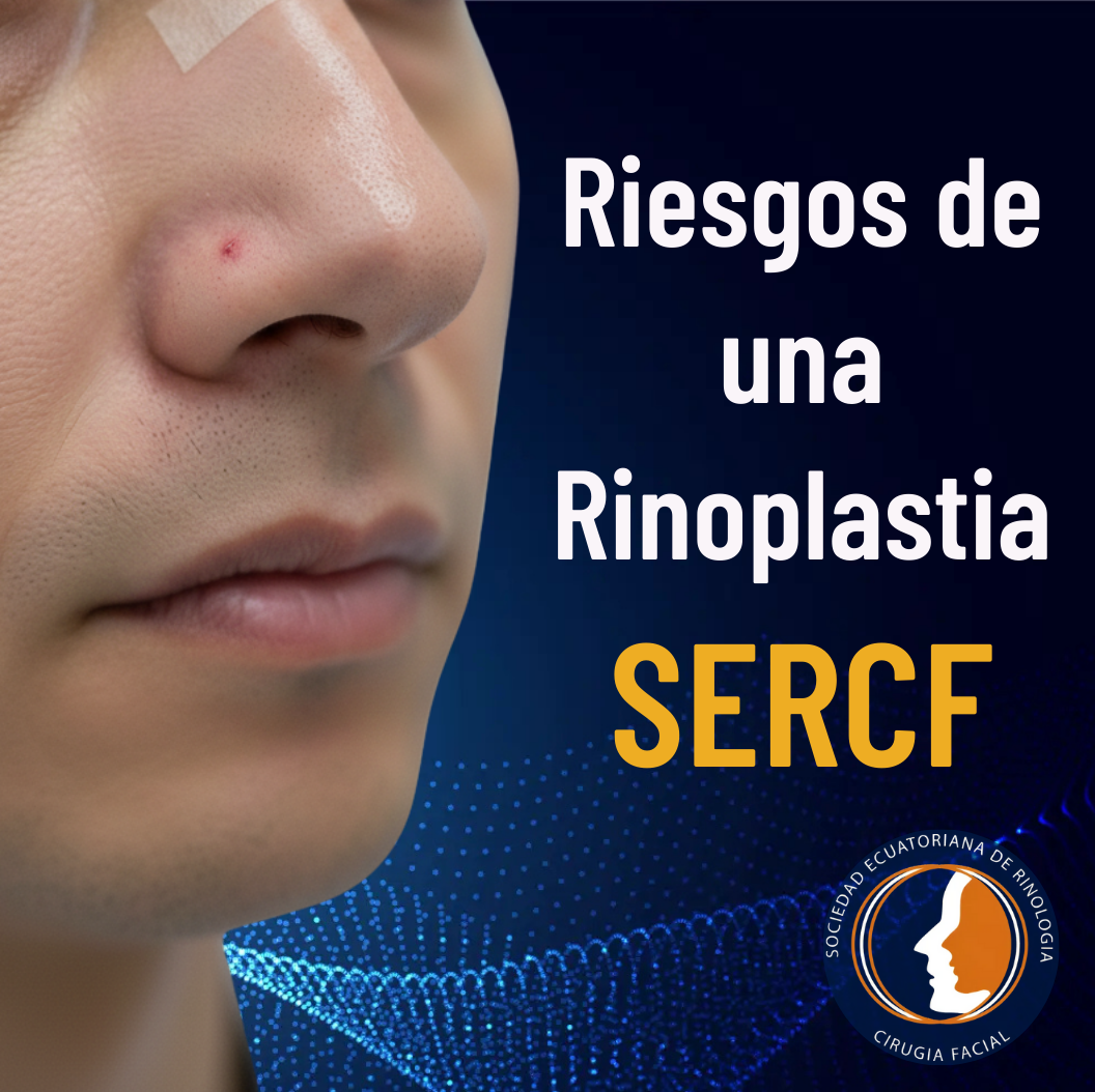 Riesgos de una Rinoplastia